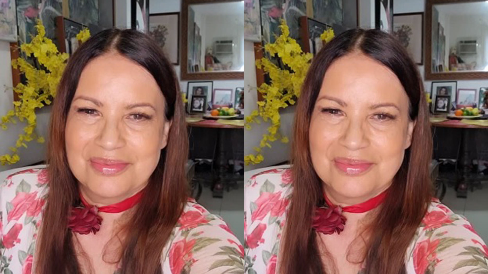 Isadora Ribeiro mostra testa sangrando e relata acidente: ‘Um susto’