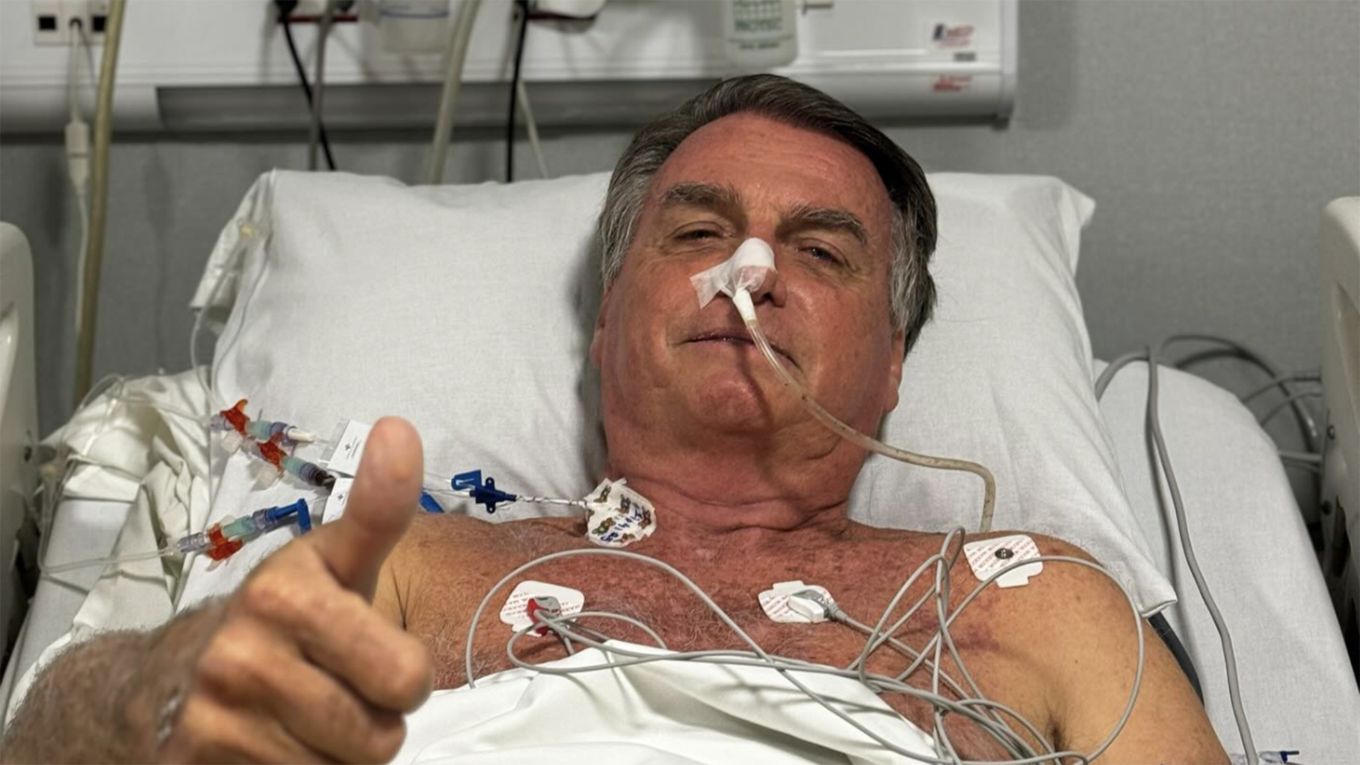 Médico de Jair Bolsonaro revela quais complicações podem acontecer no pós-operatório