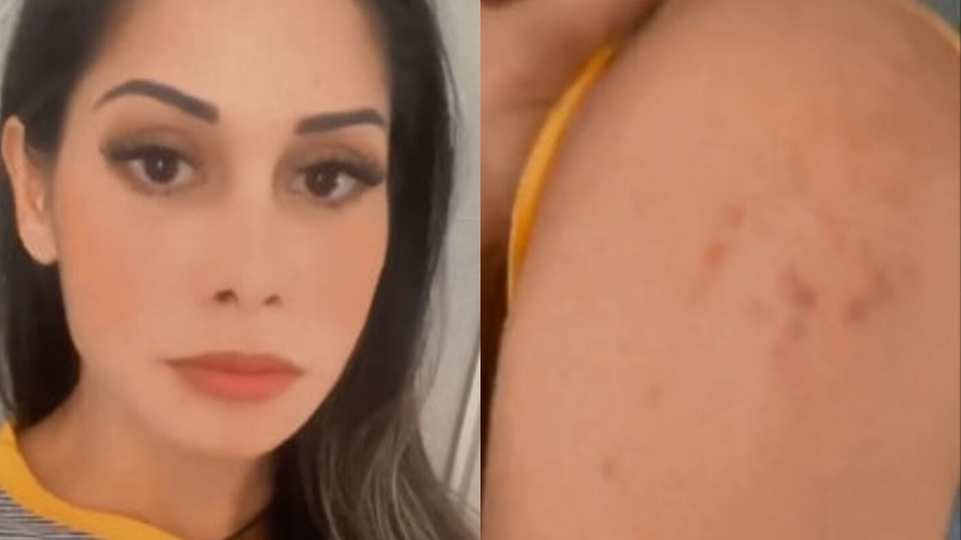 Médica explica diagnóstico de Maíra Cardi: ‘Raiz do problema’