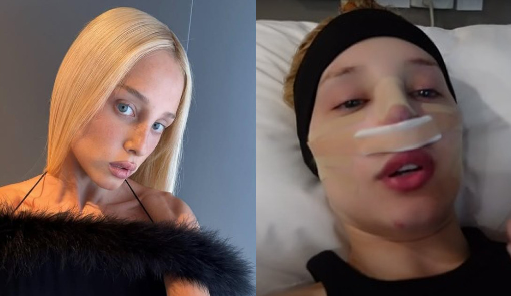 Médica comenta cirurgia da influenciadora Malu Borges: ‘É preciso avaliar com precisão’