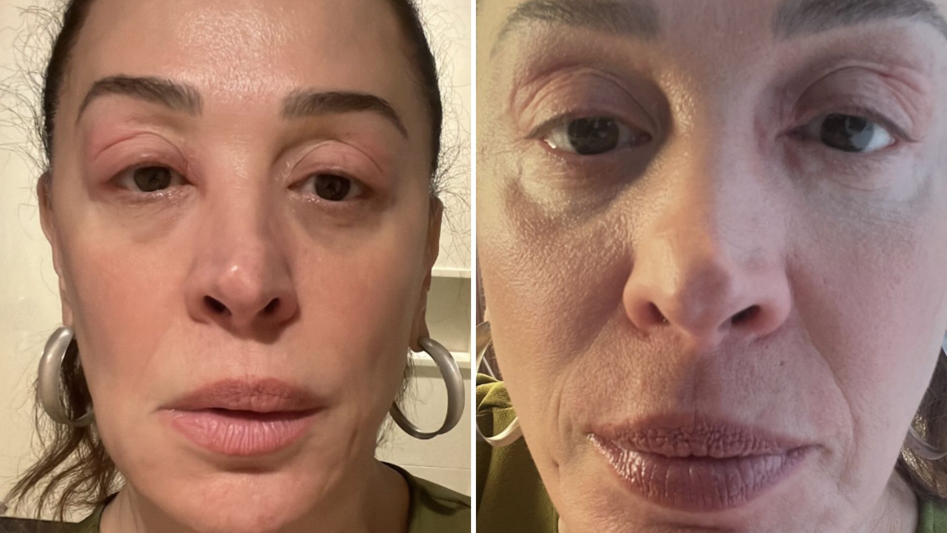 Médica alerta Claudia Raia sobre doença: ‘Potencialmente fatal’