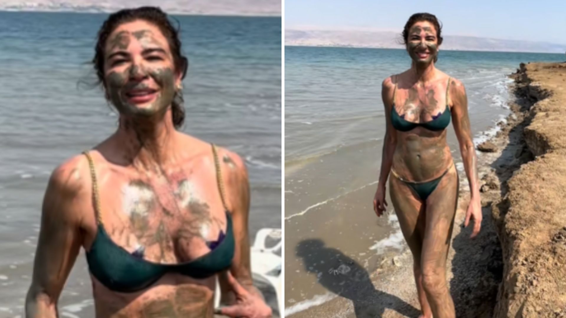 Médica aponta erro em ritual de beleza de Luciana Gimenez: ‘Reações indesejadas’