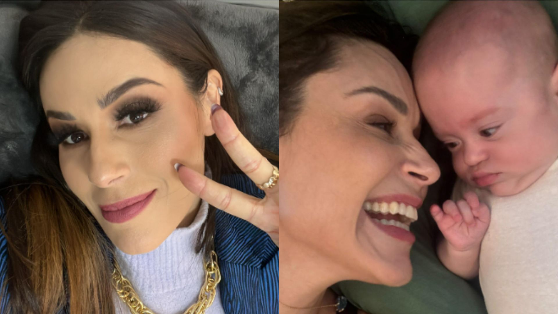 Após cirurgia de Nadja Haddad, cirurgião explica como identificar e tratar a diástase abdominal