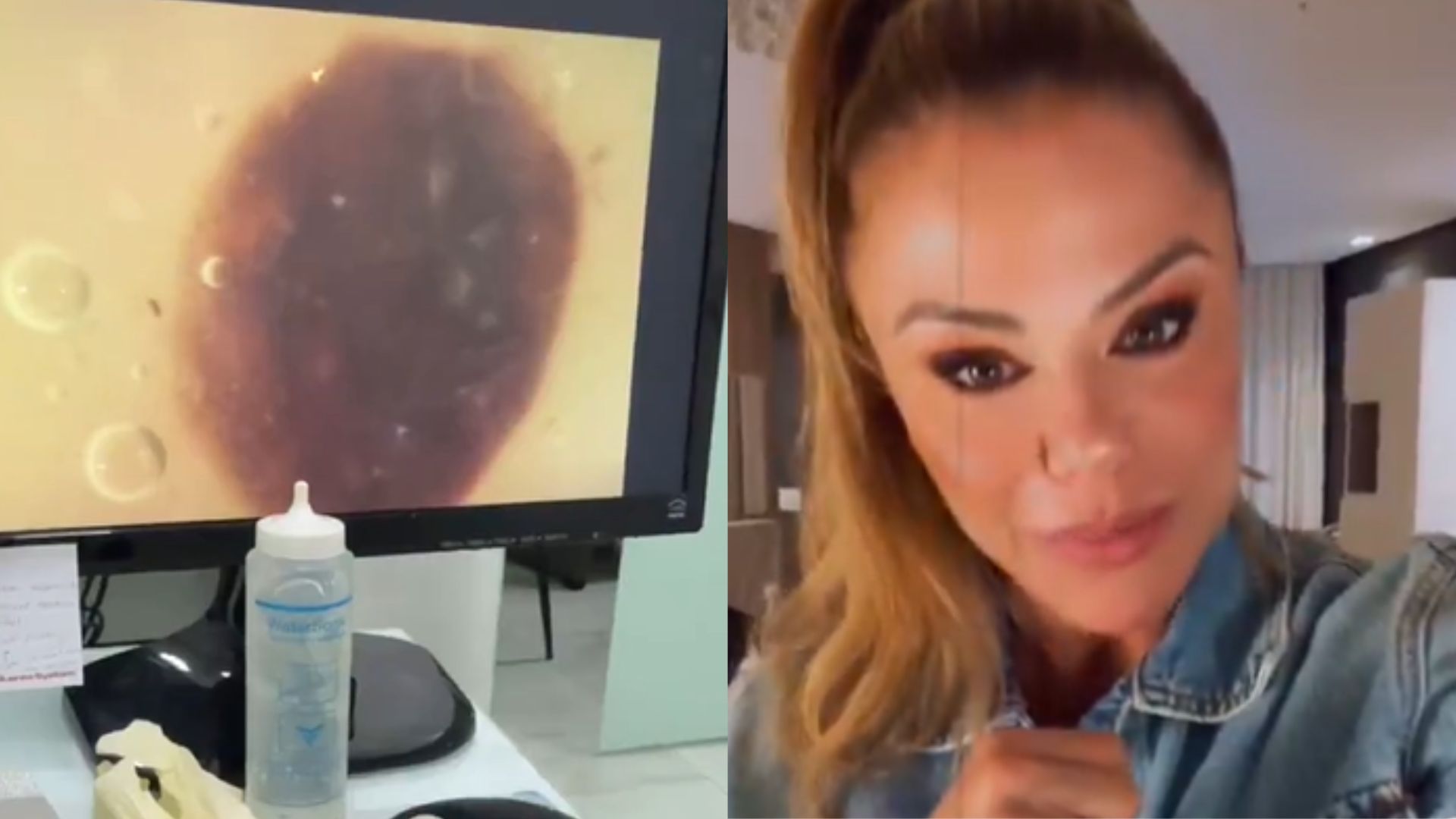 Poliana Rocha vai ao médico após descobrir pinta suspeita na mão