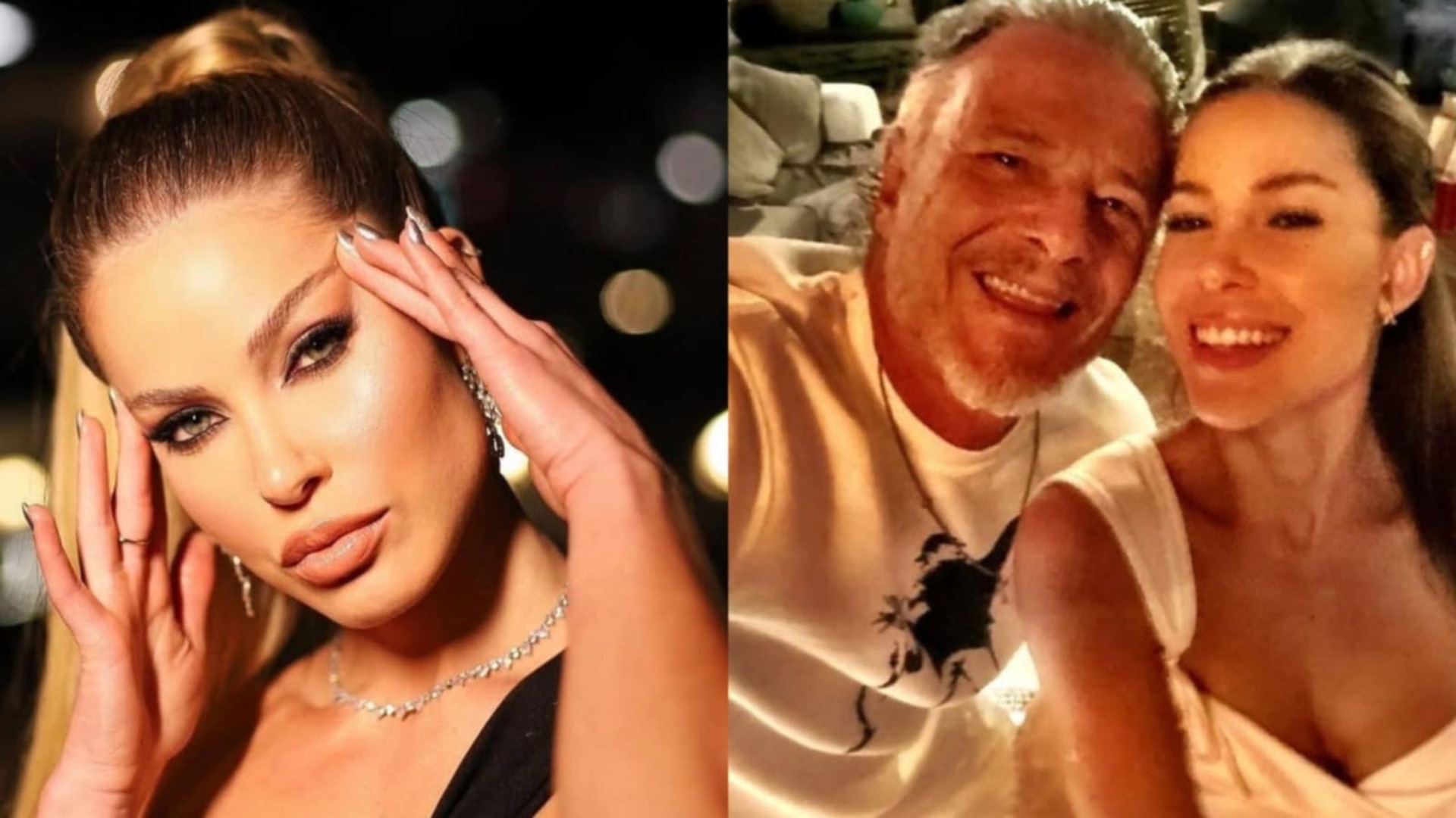 Médico explica preenchimento que acabou com o namoro de Marcello Novaes
