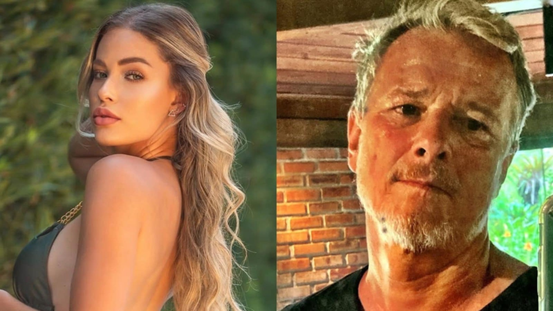 Saory Cardoso mostra preenchimento que acabou com seu namoro com Marcello Novaes