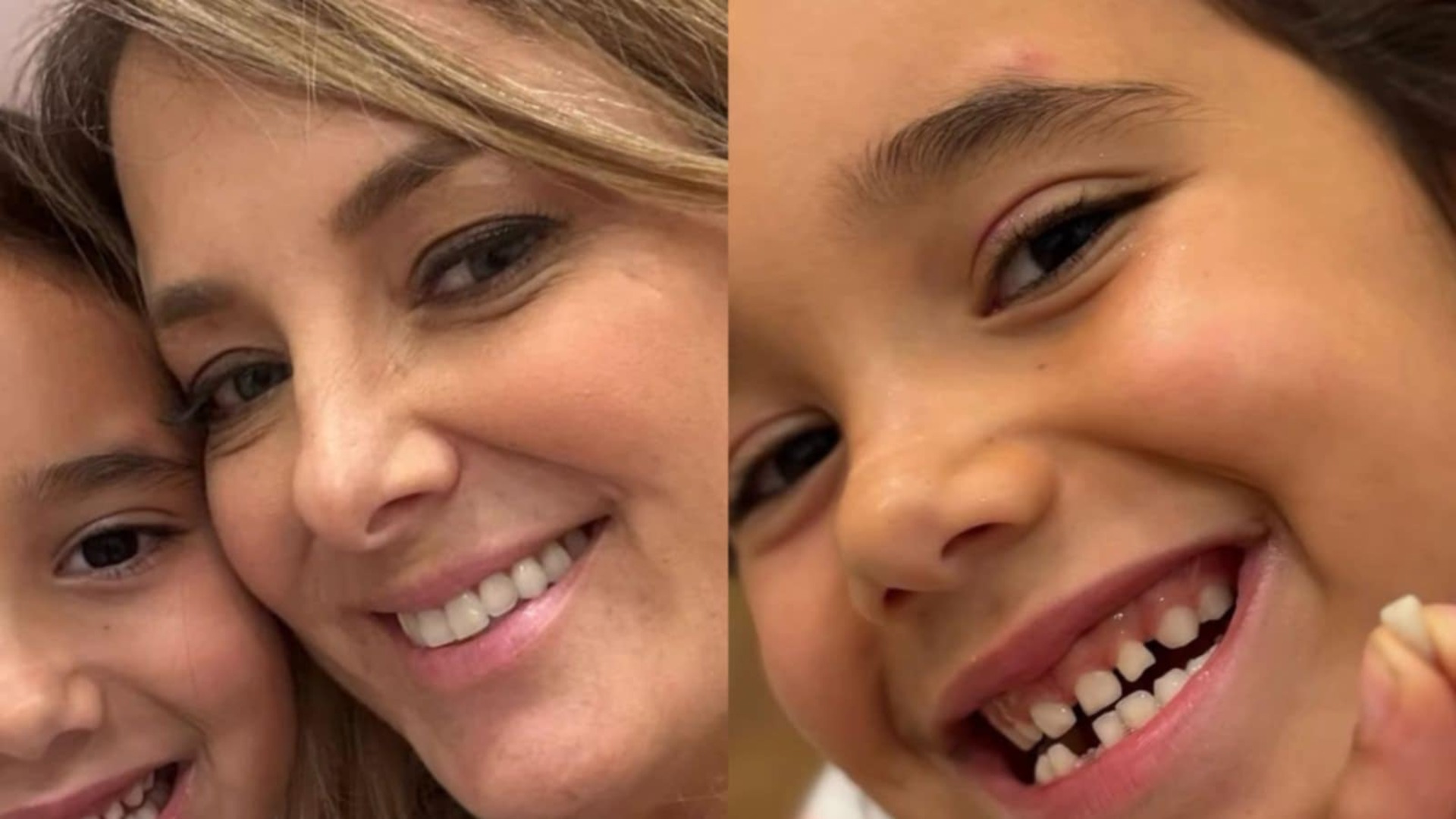 Ticiane Pinheiro mostra nova fase da filha caçula: ‘Caiu primeiro dentinho’