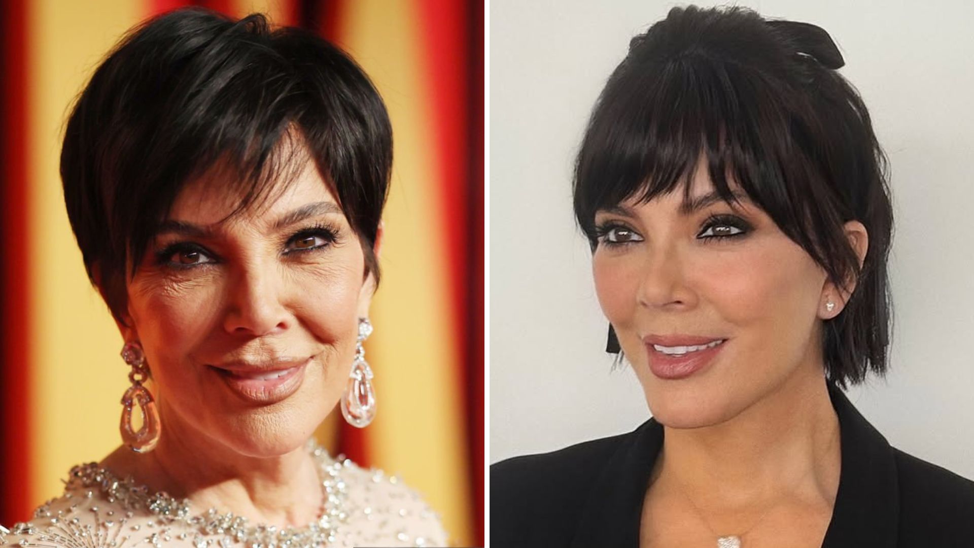 69 anos com rosto de 20? Dermatologista explica rejuvenescimento de Kris Jenner