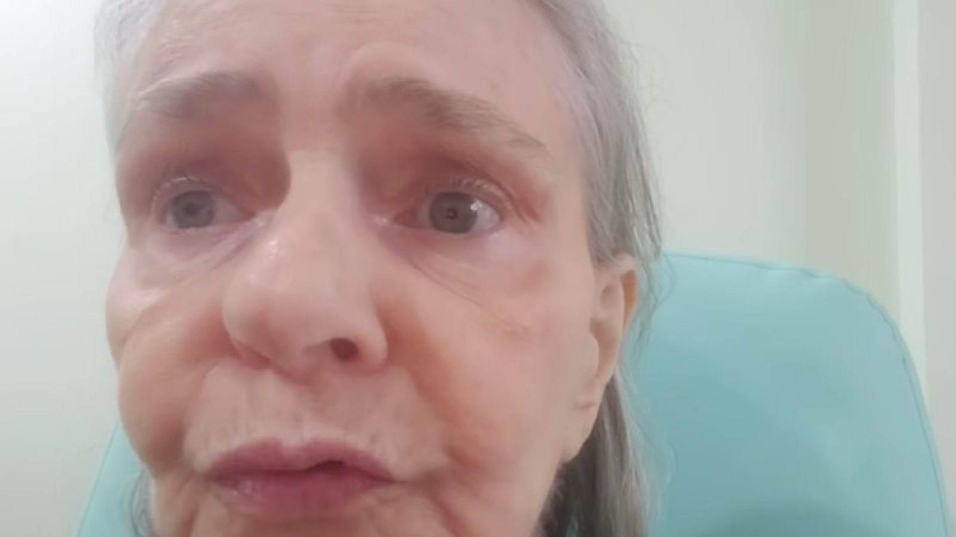 Médico explica diagnóstico de Angela Ro Ro e fala sobre suspeita de câncer: ‘Com risco de…’