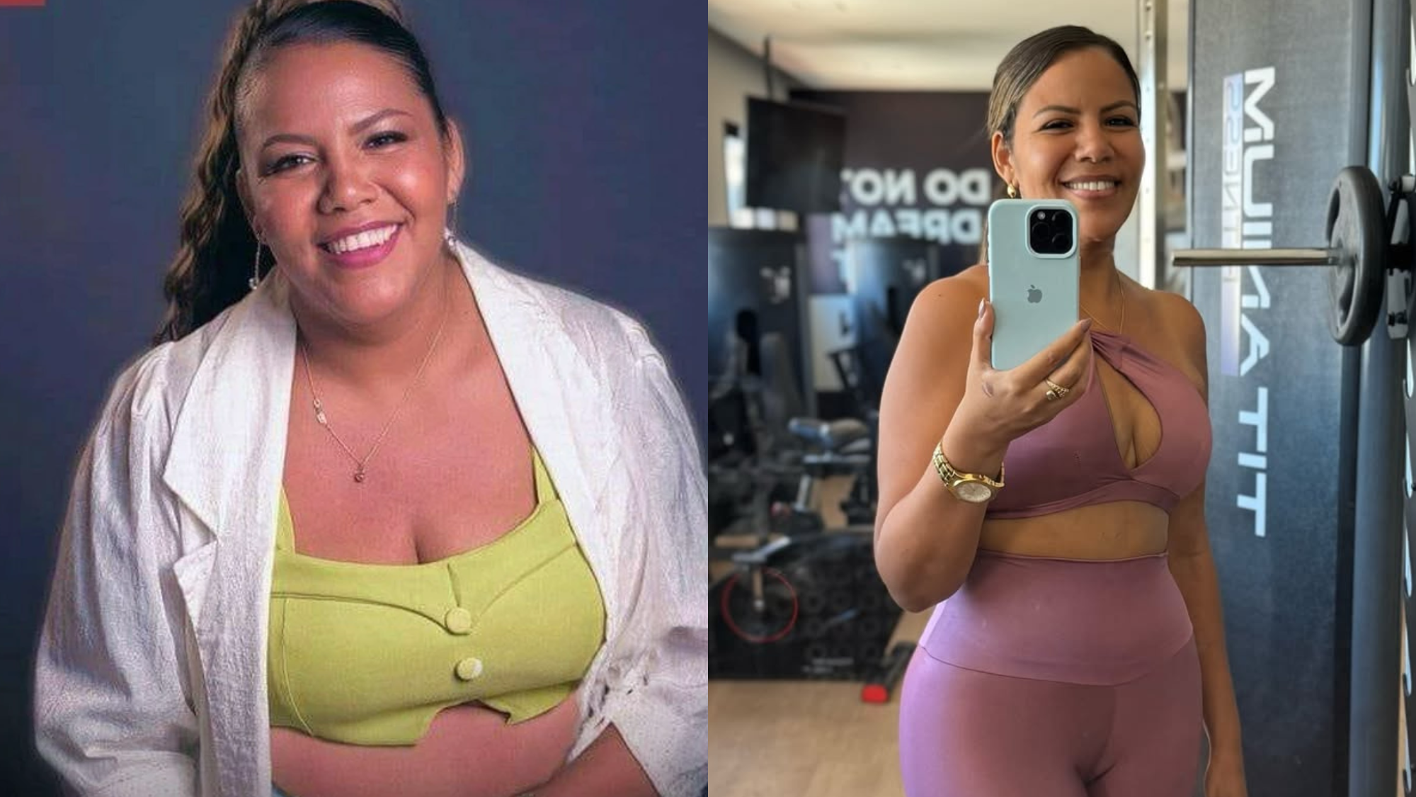 Especialista explica cirurgia estética de Mani Reggo: ‘Uma dessas mulheres corajosas’