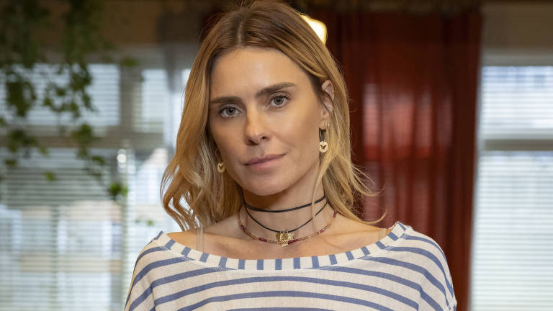 Médico alerta sobre reação alérgica de Carolina Dieckmann: ‘Gravidade’