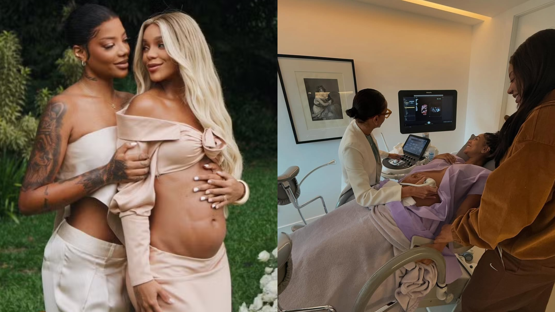 Médico alerta sobre ultrassom de alta tecnologia realizado por Brunna e Ludmilla: ‘Marketing’