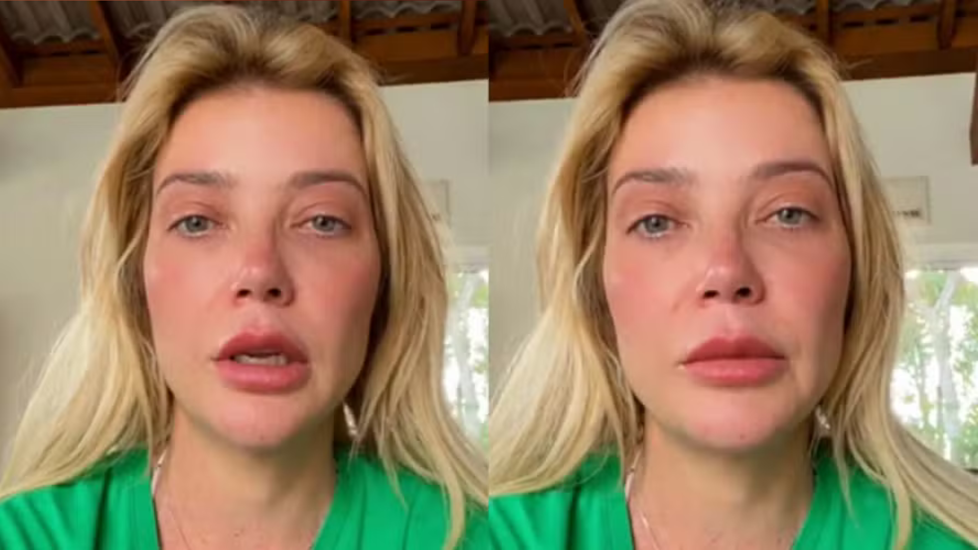 Médico alerta sobre cirurgia às pressas de filho de Luiza Possi: ‘Sem sequelas’