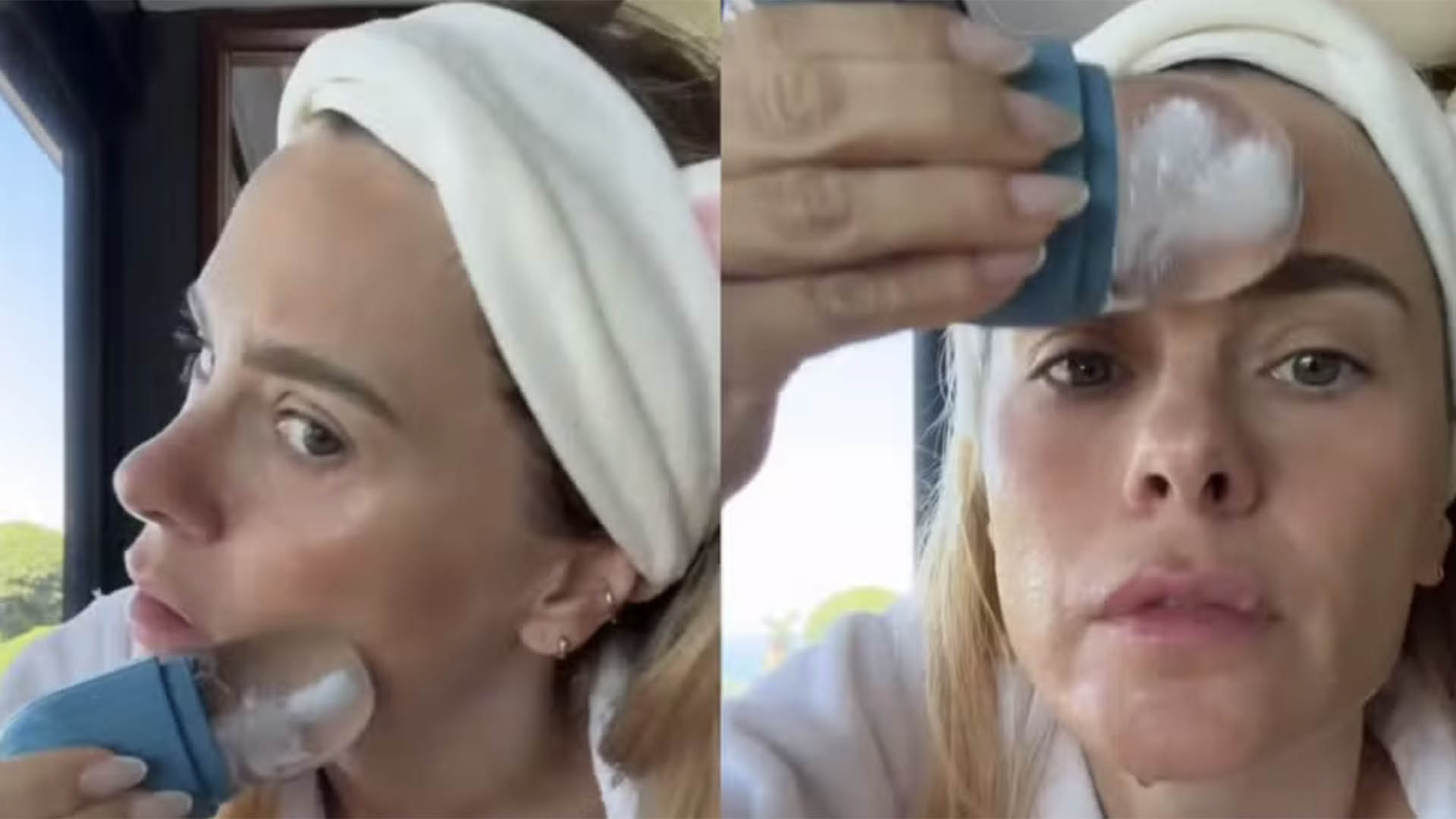Médica alerta para os riscos de truque de beleza de Carolina Dieckmann: ‘Jamais’
