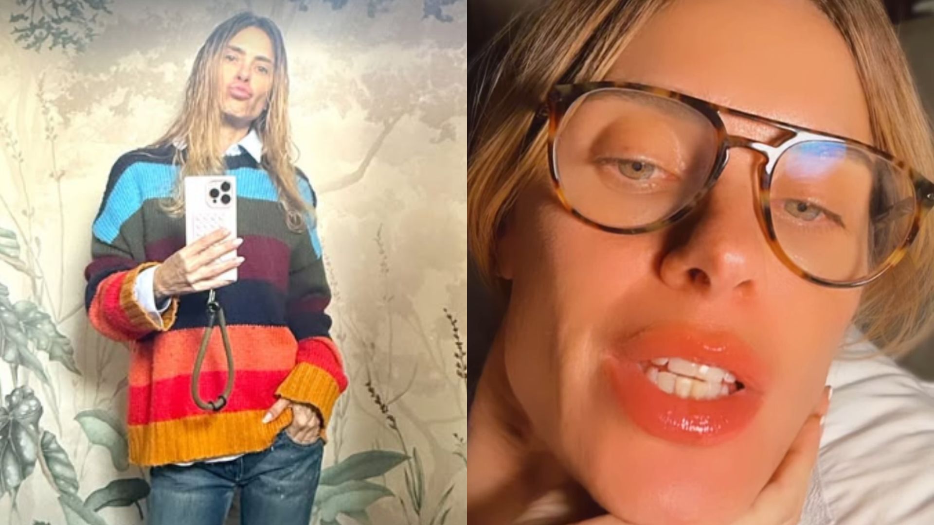 Carolina Dieckmann relata reação alérgica nos lábios: ‘Toda queimada’
