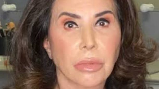 Médica explica quadro que atingiu Claudia Alencar em internação: ‘Entope ou dificulta’