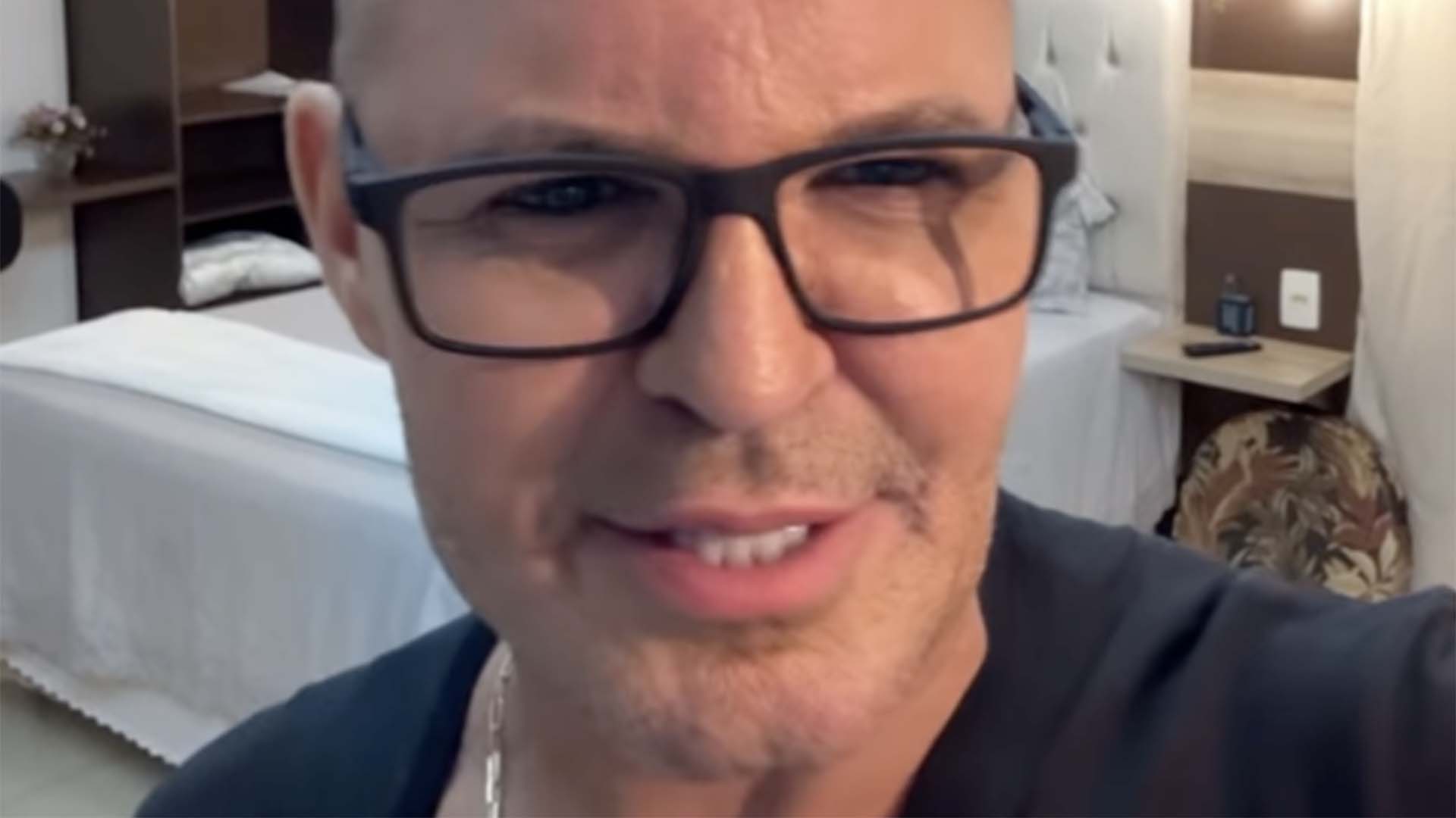 Eduardo Costa surge careca em show e explica o motivo