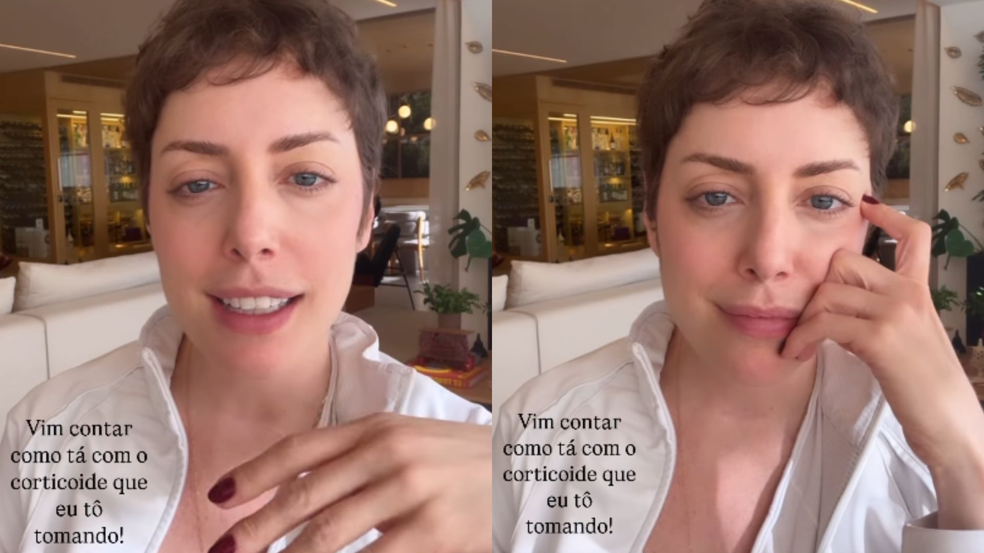 Fabiana Justus relata reação do corpo ao transplante de medula: ‘Ataca’