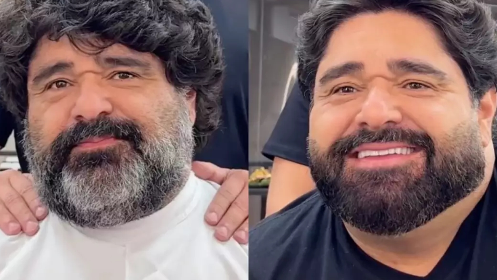Médica explica mudança no visual de Fabiano, da dupla com César Menotti: ‘É reflexo’