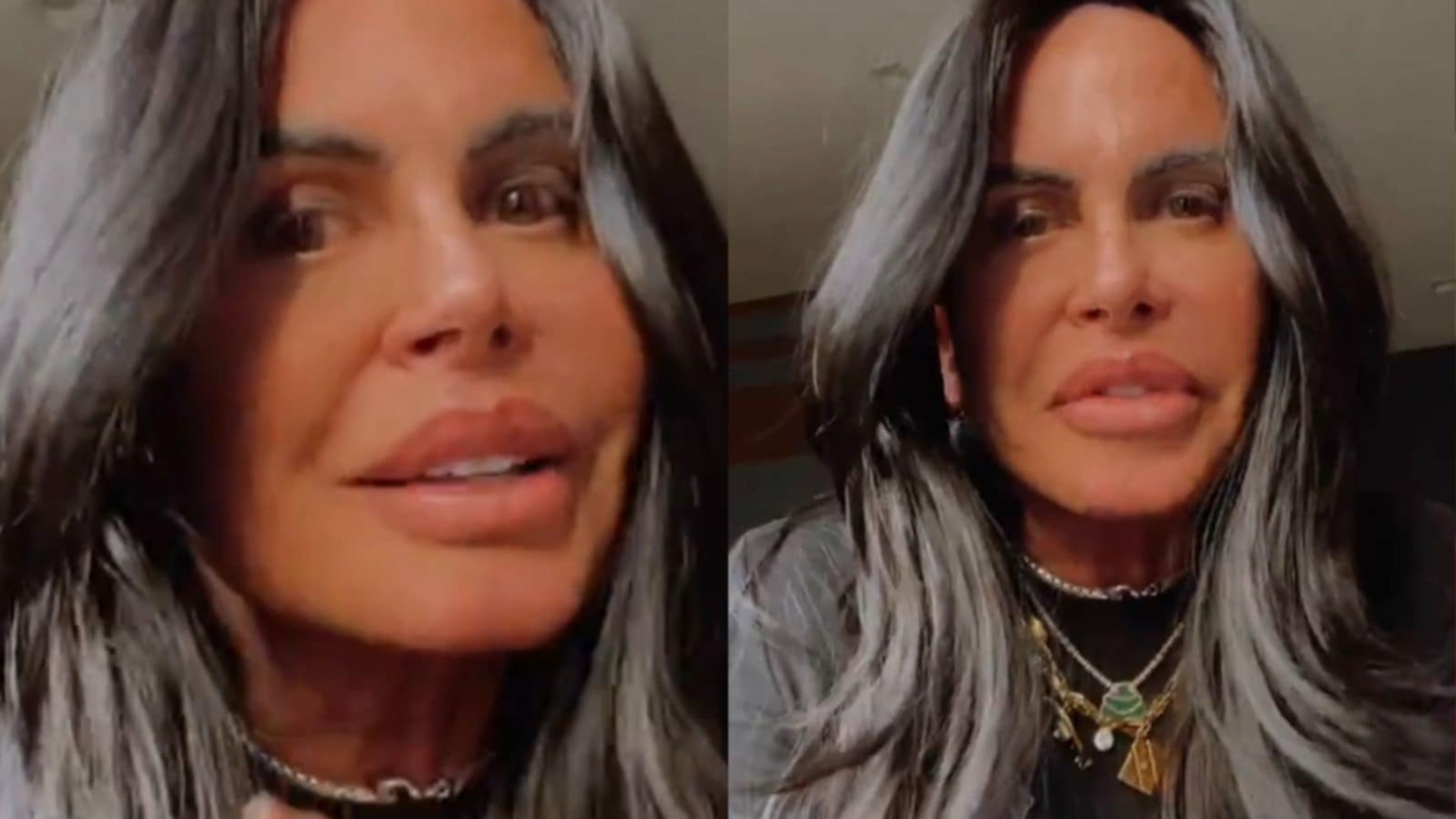 Especialista alerta sobre riscos de novo procedimento de Gretchen: ‘Complicações’