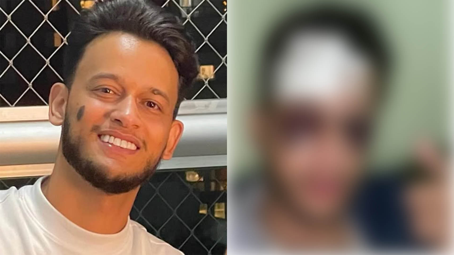 Cantor sertanejo sofre traumatismo craniano e surge quase irreconhecível
