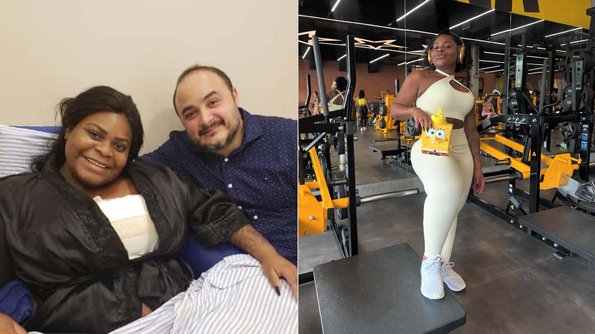 Médico de Jojo Todynho lista as cirurgias e procedimentos que ela já fez