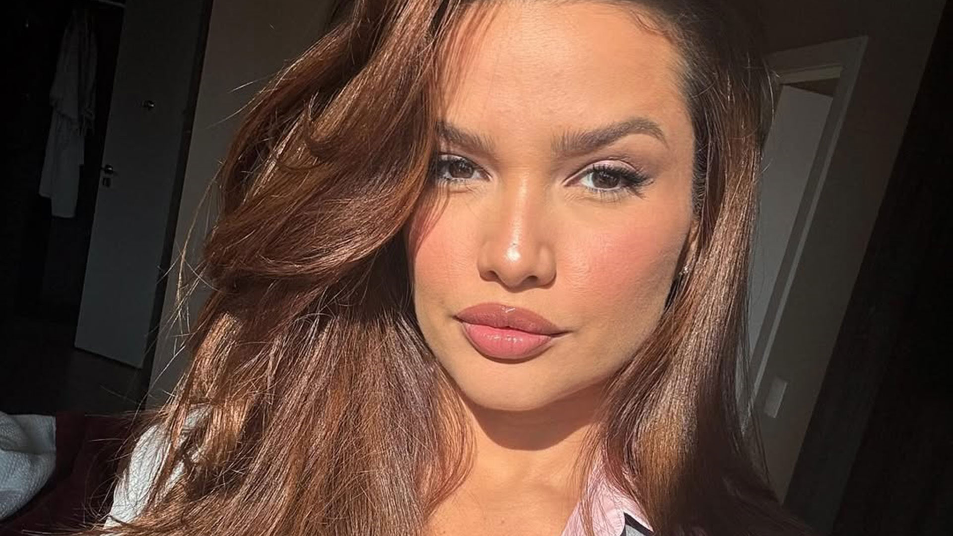 Juliette atualiza sobre fratura no nariz e revela sobre médico: ‘Vai brigar’