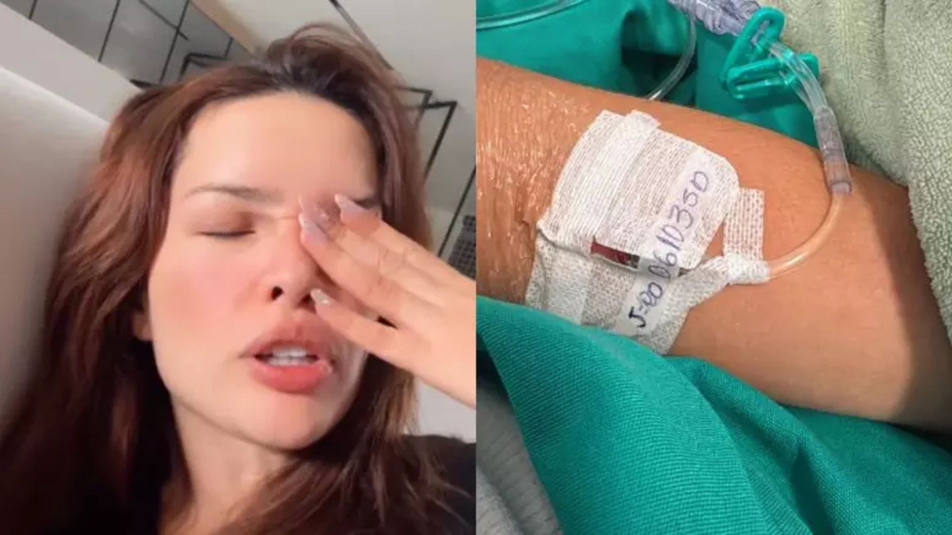 Médico alerta riscos de fratura que Juliette sofreu: ‘Pode levar à necrose’