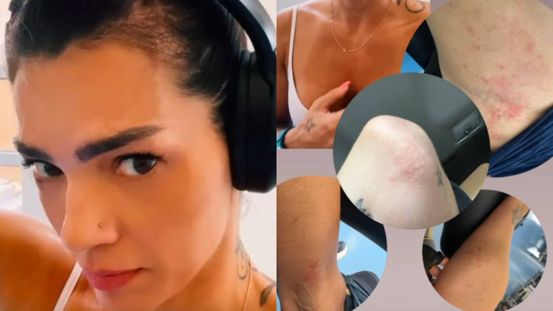 Médica explica diagnóstico de Kelly Key e revela sobre tratamento: ‘Doença incurável ‘