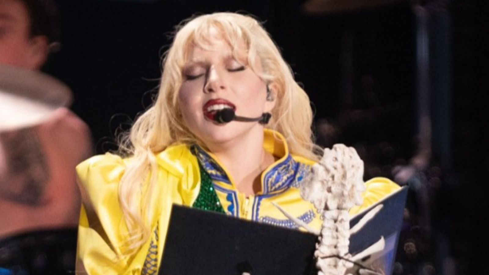 Lady Gaga desafia diagnóstico com turnê e médico explica: ‘Síndrome não progressiva’