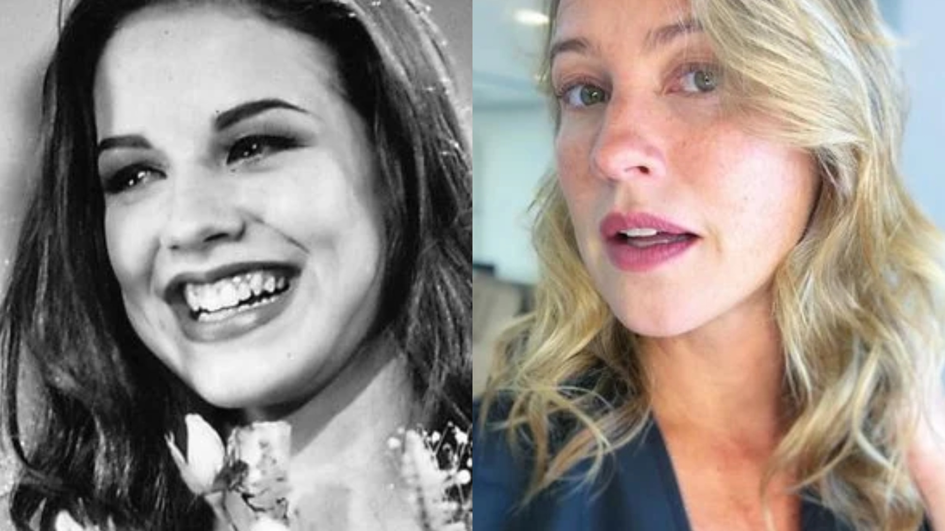 Dentista explica plástica dentária de Luana Piovani e faz alerta: “Pode comprometer’