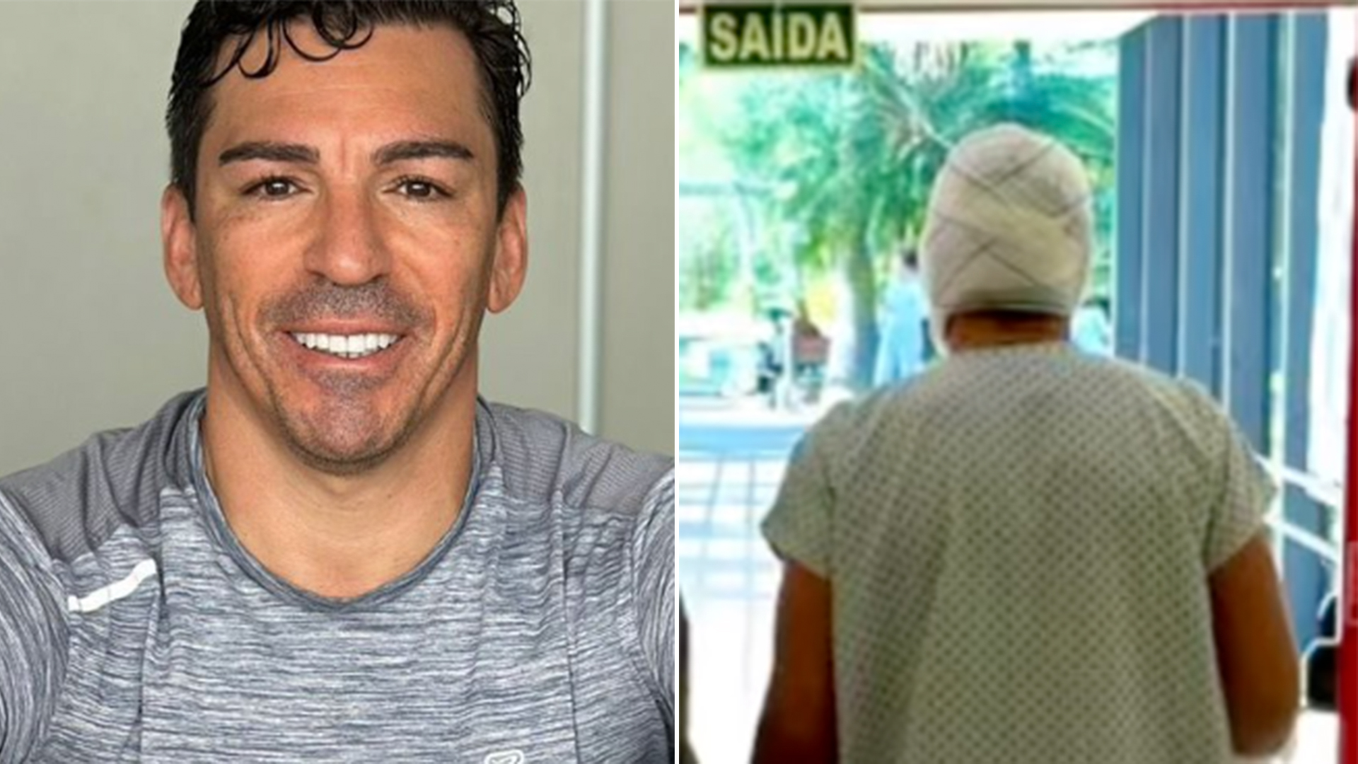 Ex-jogador Lúcio mostra o rosto pela primeira vez após sofrer queimaduras