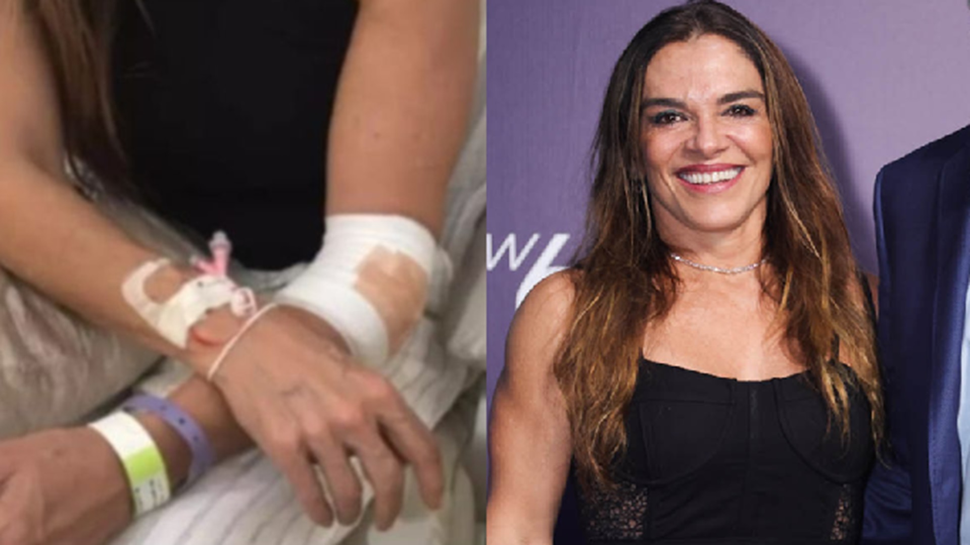 Atriz que foi atropelada por manobrista conta como tudo aconteceu: ‘Podia ter morrido’