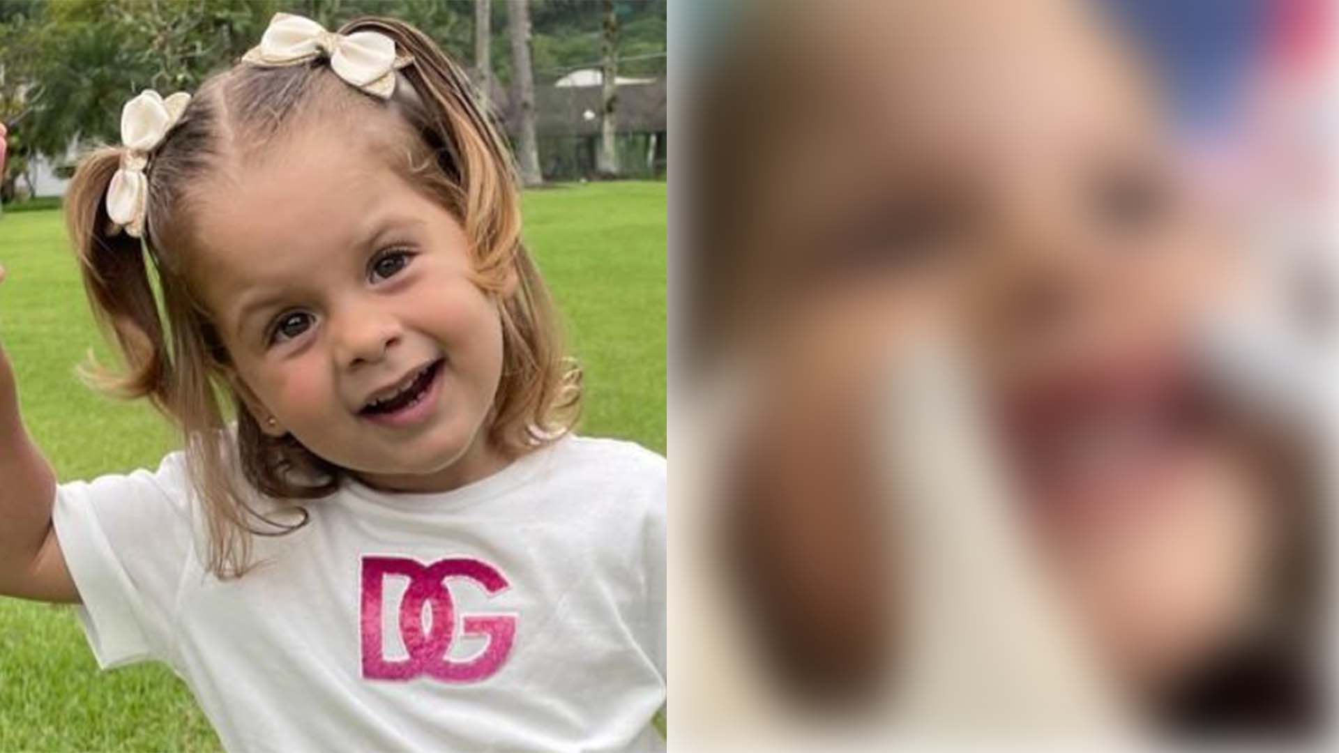 Maria Flor, filha de Virginia, coloca aparelho nos dentes com apenas 2 anos