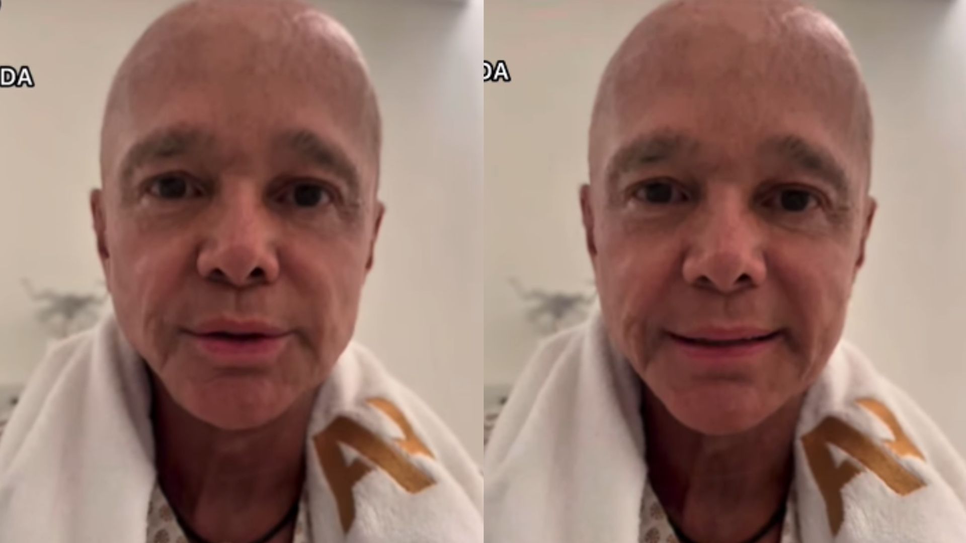Médico fala de complicações de tumor de Netinho: ‘Inchaço’
