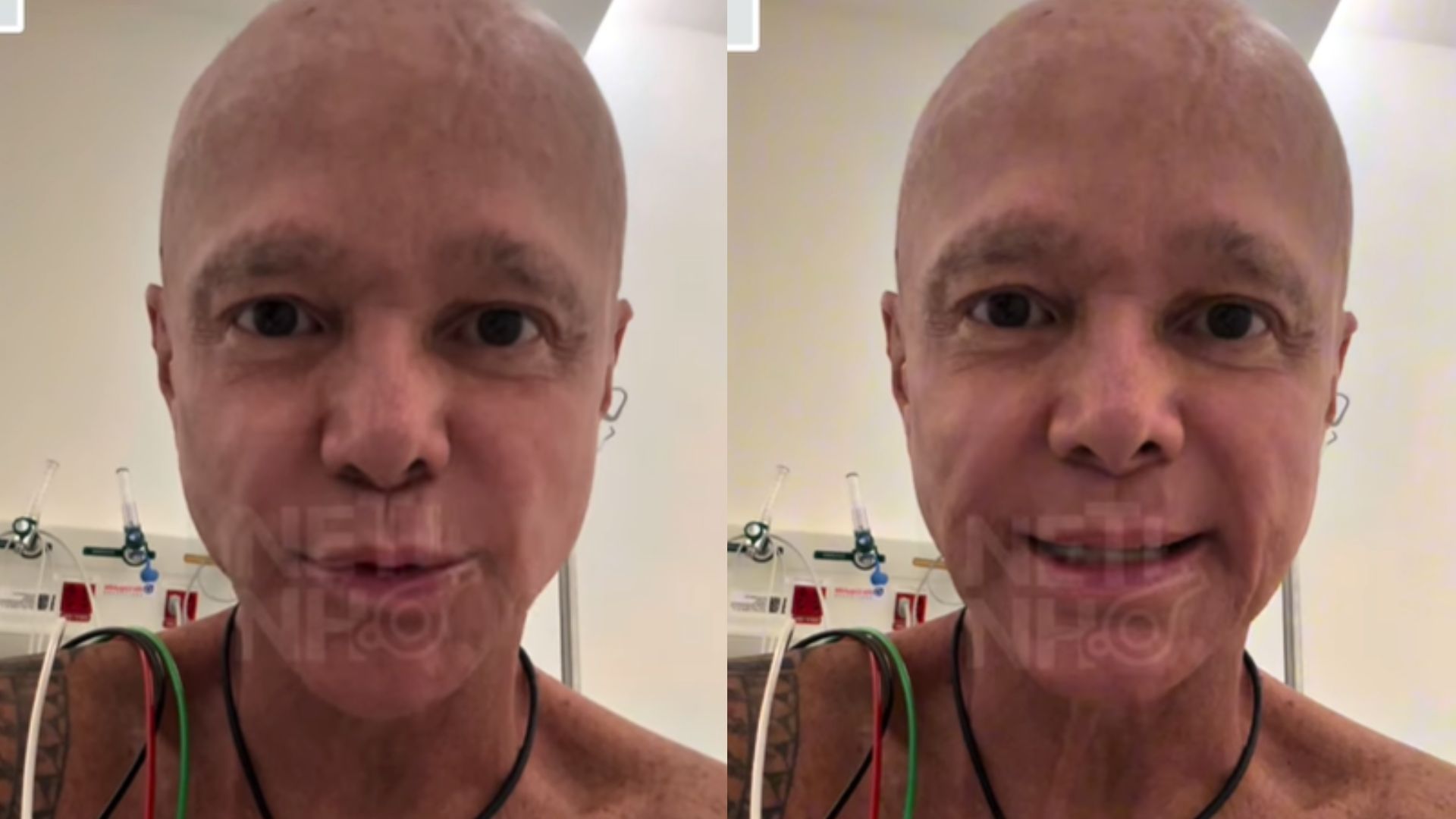 Netinho explica etapas de seu tratamento contra o câncer: ‘128 injeções’