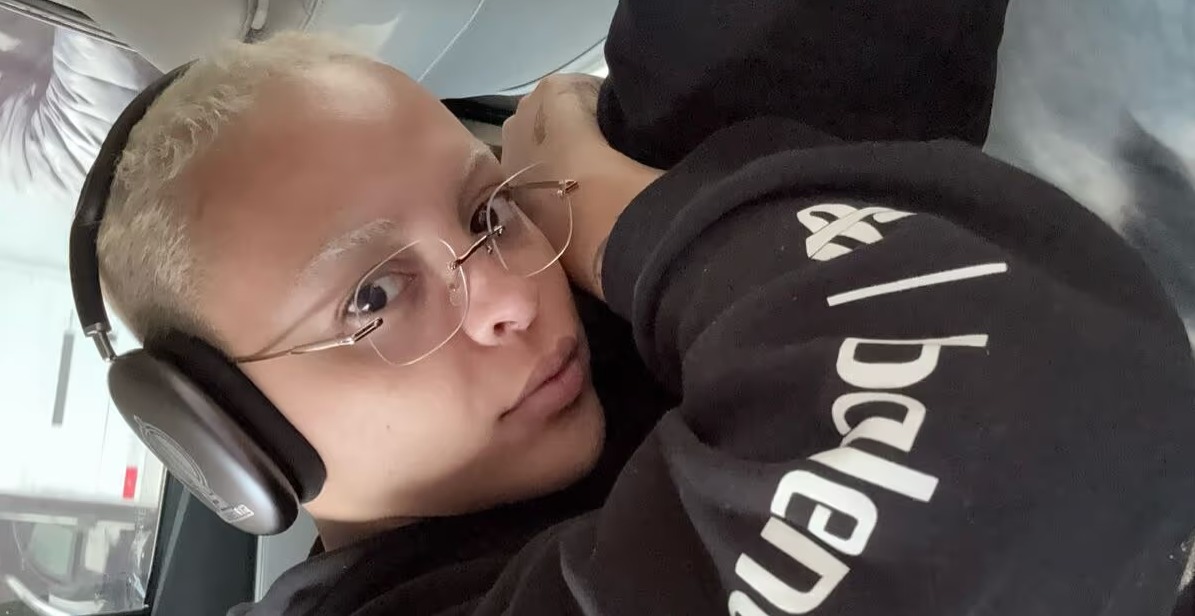 Médico alerta para doença de Pabllo Vittar: ‘Deve evitar esses gatilhos sempre que possível’