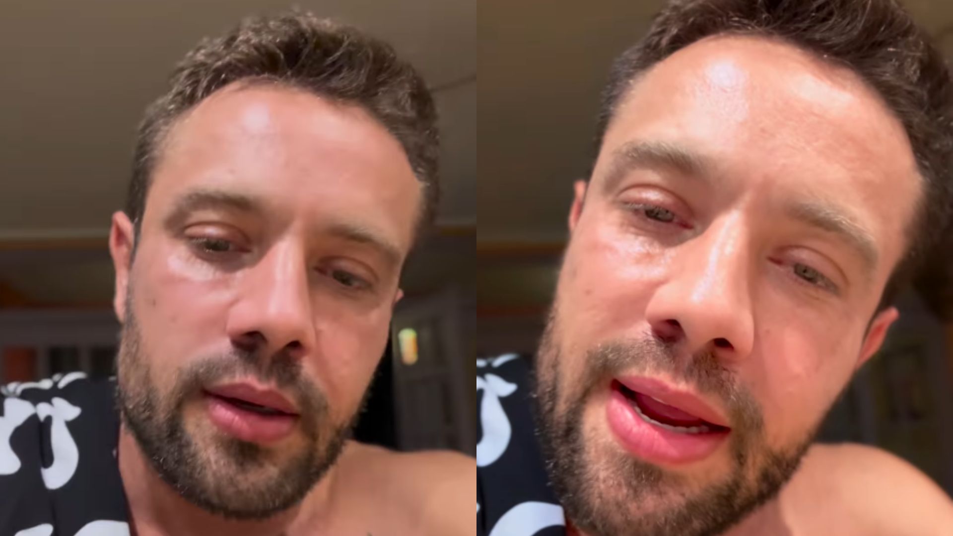 Rafael Cardoso preocupa internautas ao surgir com eletrodos no corpo: ‘A vida não para’