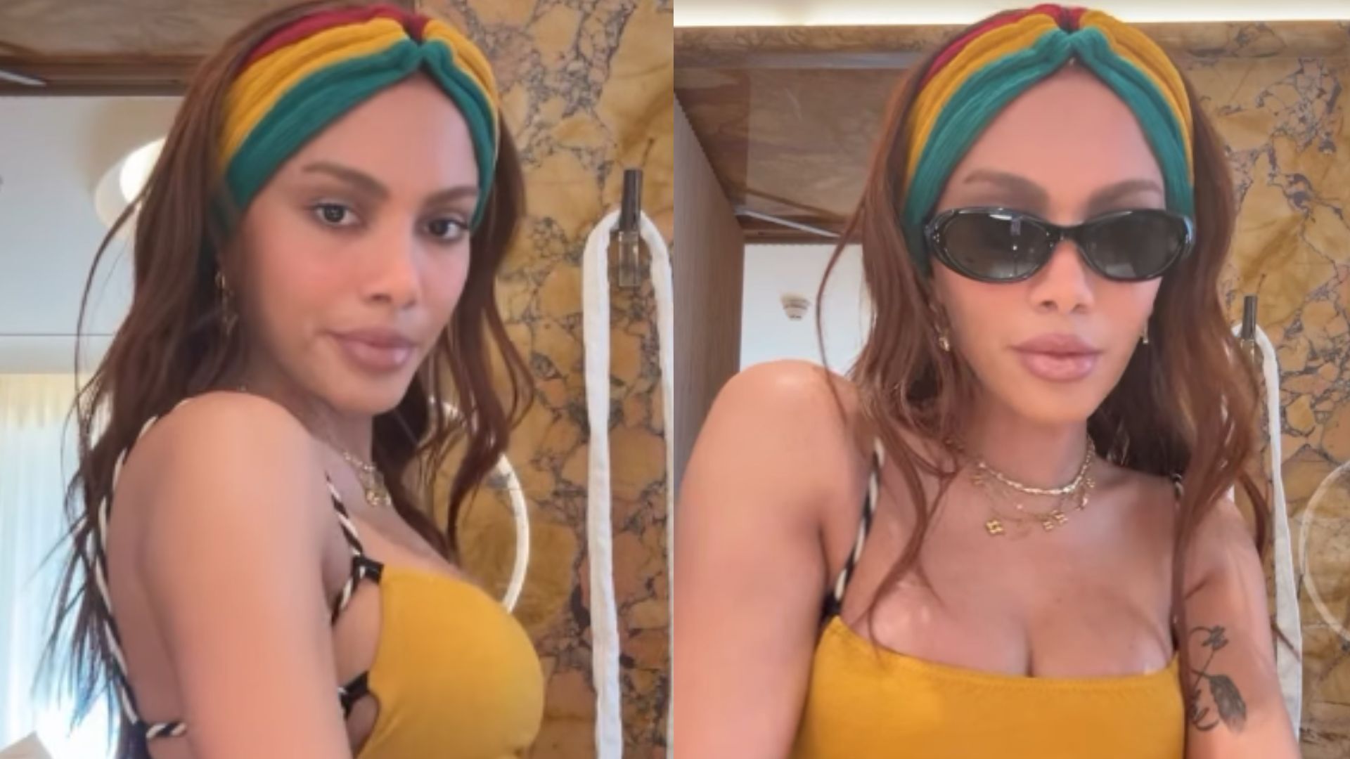 Anitta reaparece em vídeo após se recuperar de infecção bacteriana