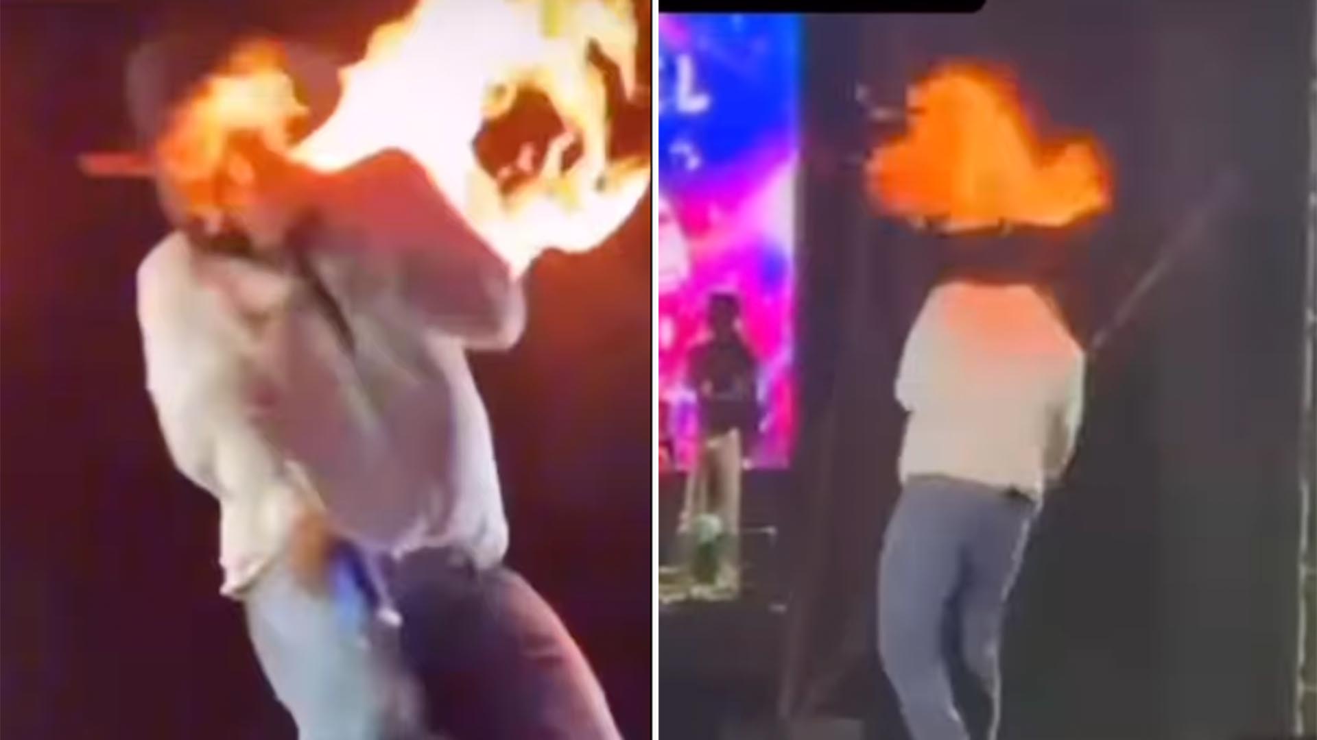 Cantor Léo fica com o rosto queimado após acidente no palco