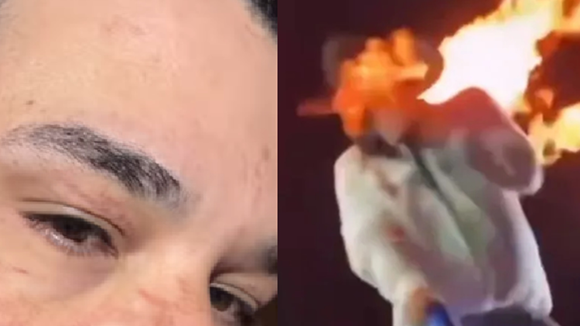 Cantor Léo mostra cicatrizes após ser atingido por fogo durante show