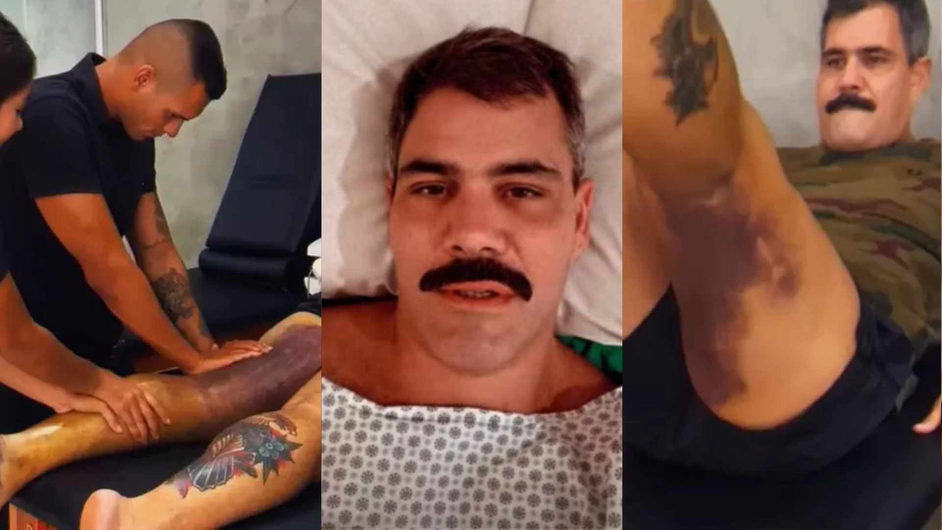 Médico alerta sobre hematomas em Juliano Cazarré após duas cirurgias: ‘Risco’