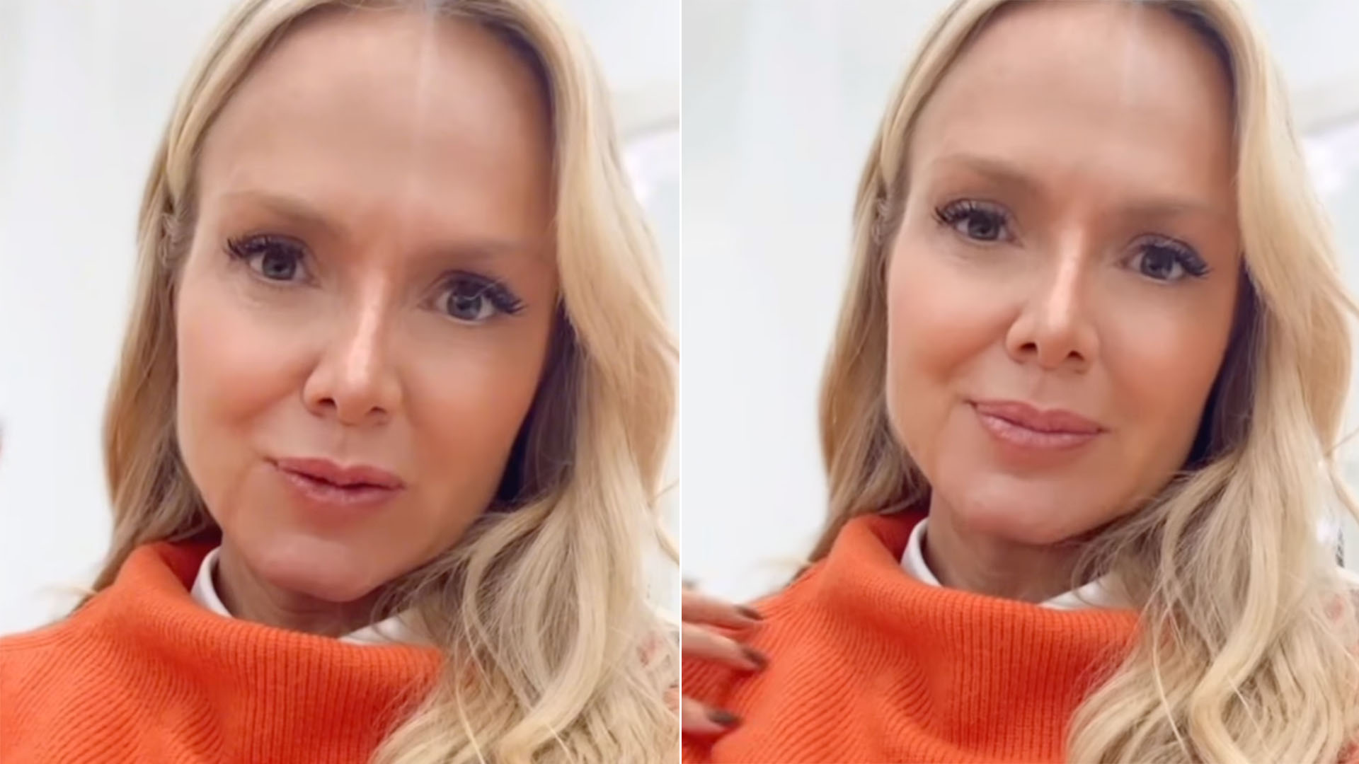 Eliana explica problema que a fez passar por cirurgia: ‘Capsulite adesiva’