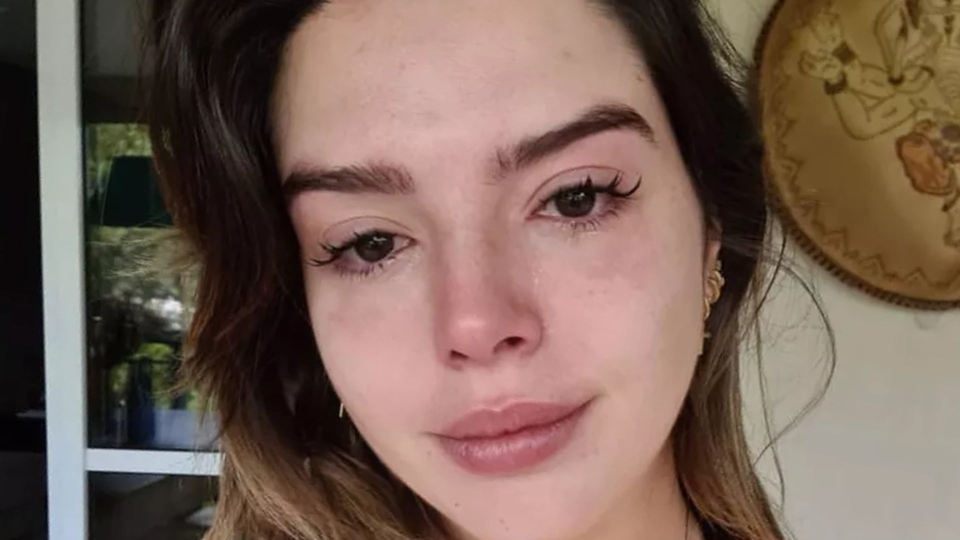 Giovanna Lancellotti revela cirurgia por pressão e médica avalia: ‘Muito forte’