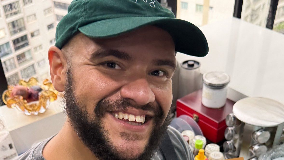 Gominho fala sobre ter eliminado 53 kg e médico explica: ‘Resultados duradouros’
