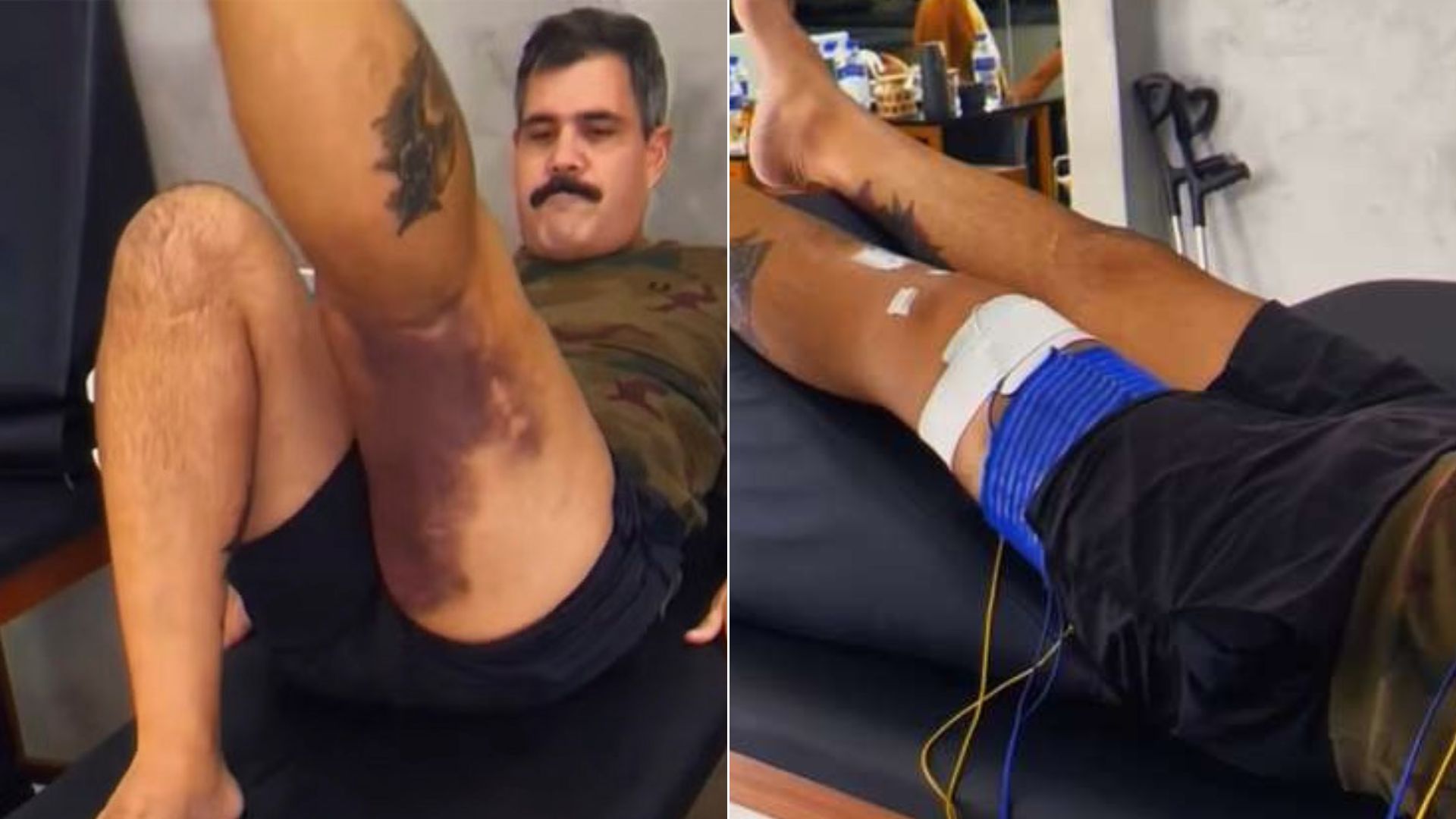 Juliano Cazarré mostra etapa da recuperação após duas cirurgias e médico alerta: ‘Fundamental’