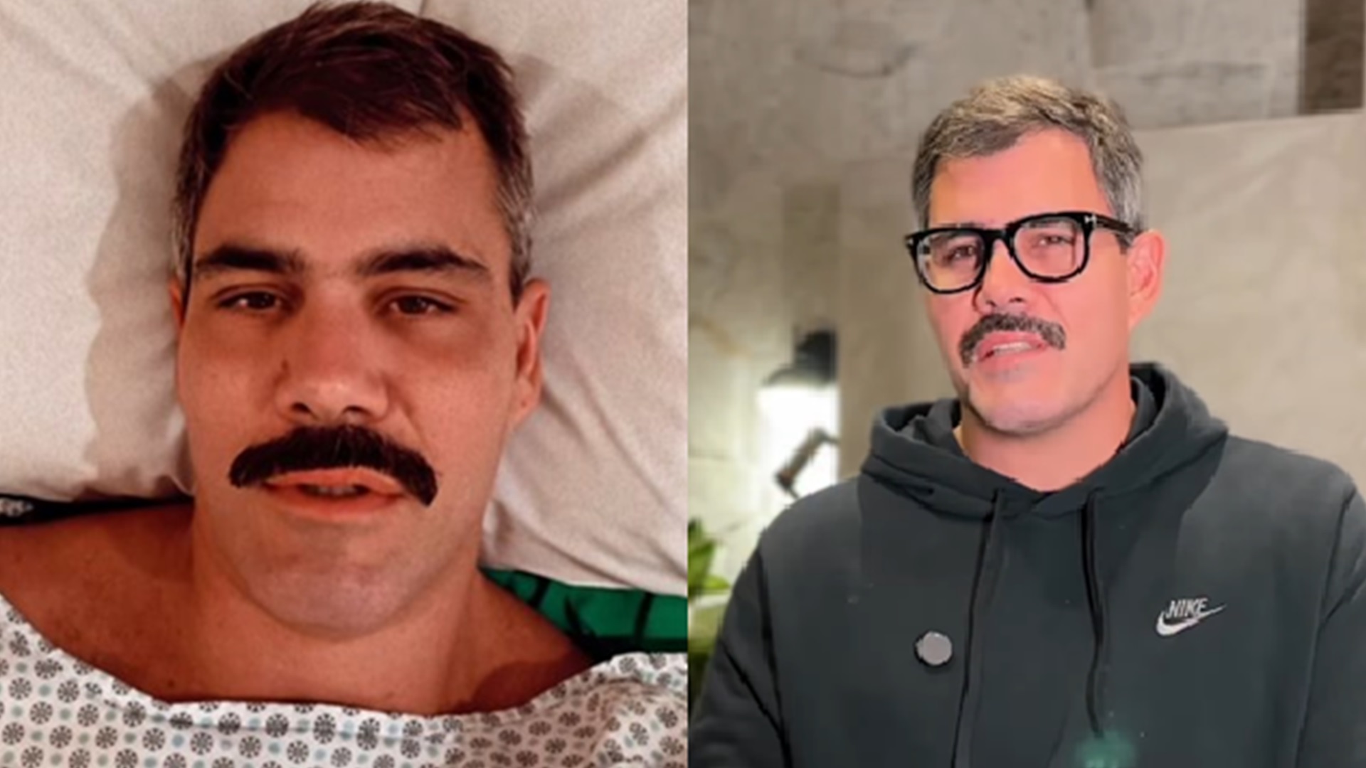 Juliano Cazarré mostra como está sua cicatriz após duas cirurgias