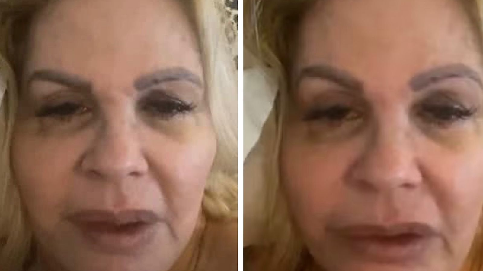 Monique Evans fala sobre diagnóstico e médico alerta: ‘Facilmente confundida com outras doenças’