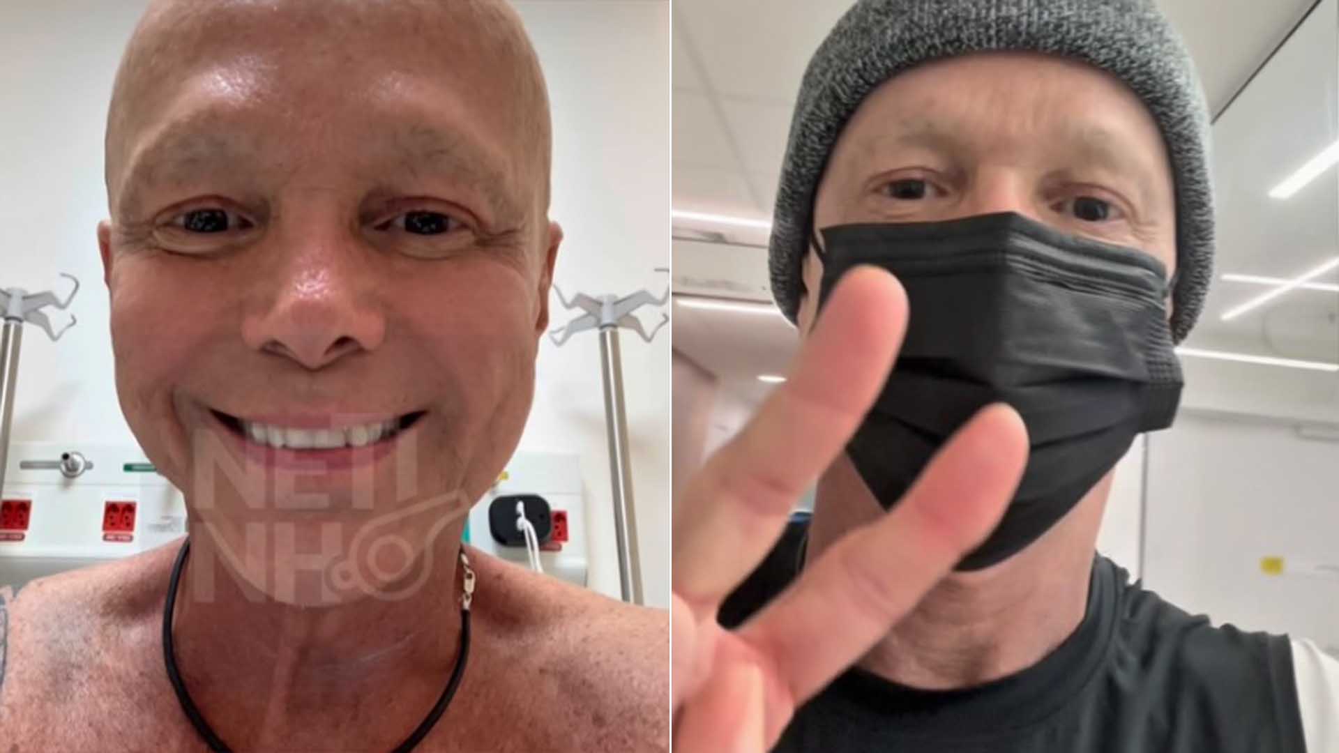 Netinho revela detalhes do tratamento contra o câncer