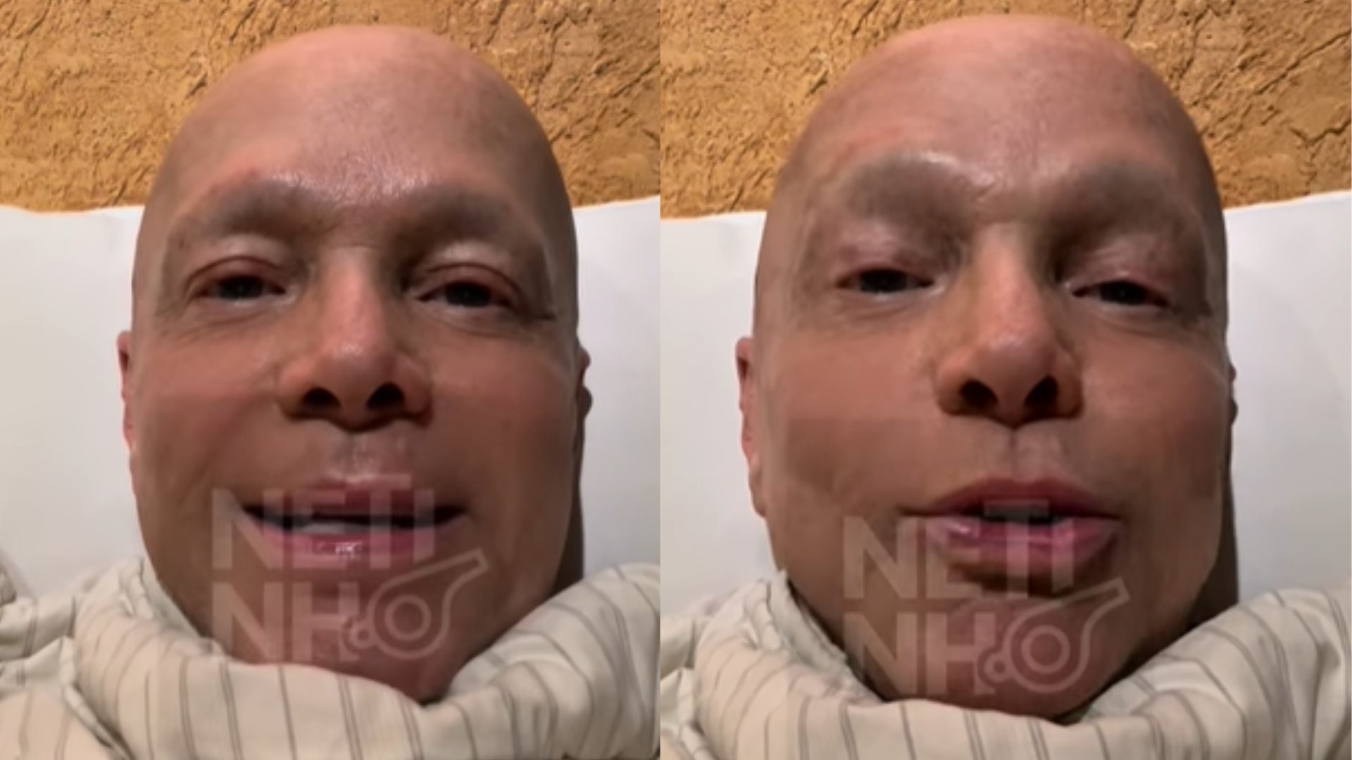 Netinho atualiza estado de saúde e revela desejo em meio à luta contra o câncer